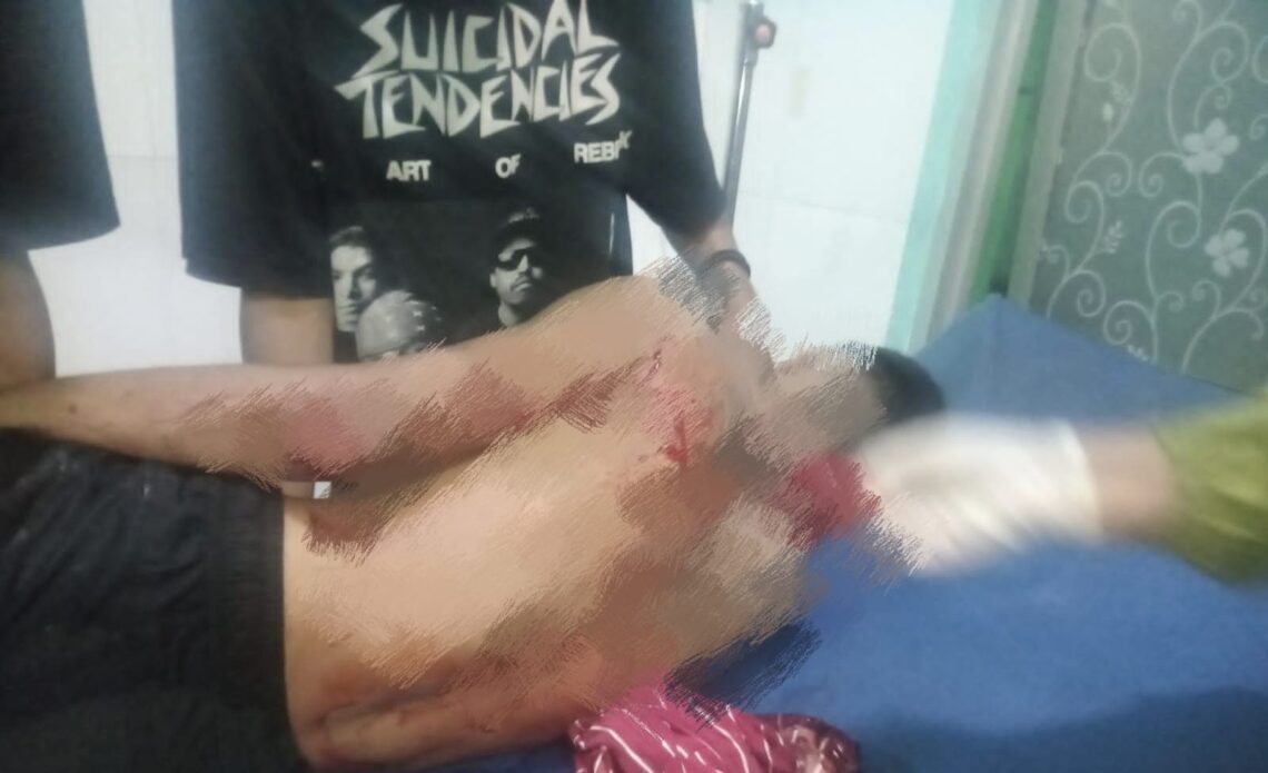 Korban saat dirawat di Puskesmas Tanggetada, Kolaka