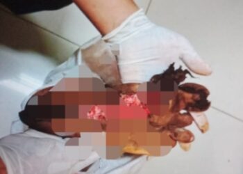 Akibat kecelakaan kerja, kaki kanan karyawan PT OSS inisial SN hancur