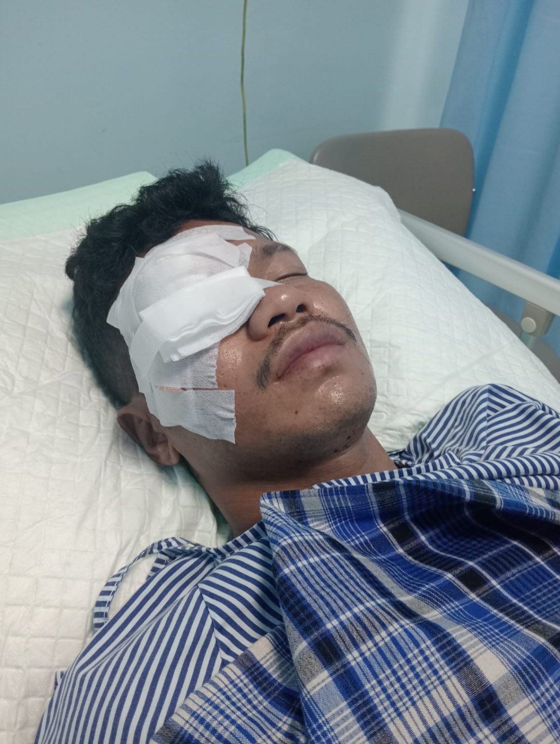 Pemuda Baubau Diduga Diserang 10 Orang Bersenjata Tajam, Berakhir Buta Permanen 10 Pemuda Baubau Diduga Diserang 10 Orang Bersenjata Tajam, Berakhir Buta Permanen