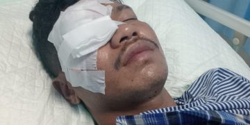 Pemuda Baubau Diduga Diserang 10 Orang Bersenjata Tajam, Berakhir Buta Permanen