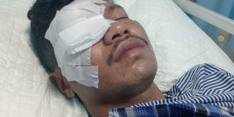 Pemuda Baubau Diduga Diserang 10 Orang Bersenjata Tajam, Berakhir Buta Permanen