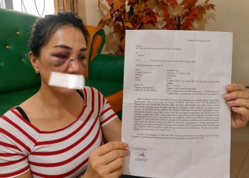 Warga Kendari Laporkan Pria ke Polisi Atas Dugaan Penganiayaan, Mengaku Dipukul 2 Kali 11 Warga Kendari Zherina Kei usai dianiaya, tampak muka memar dan bengkak