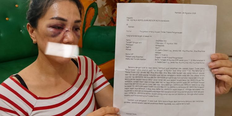 Warga Kendari Zherina Kei usai dianiaya, tampak muka memar dan bengkak