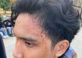 Ketua Umum HMI Komisariat FISIP UHO Cabang Kendari diduga menjadi korban penganiayaan oleh personel Satpol PP saat aksi di Kantor Gubernur Sultra