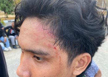 Kader HMI Kendari Diduga Dianiaya Satpol PP Saat Aksi di Kantor Gubernur Sultra