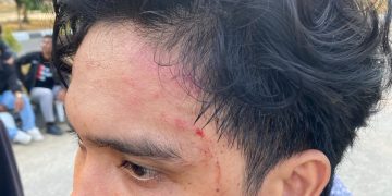 Ketua Umum HMI Komisariat FISIP UHO Cabang Kendari diduga menjadi korban penganiayaan oleh personel Satpol PP saat aksi di Kantor Gubernur Sultra