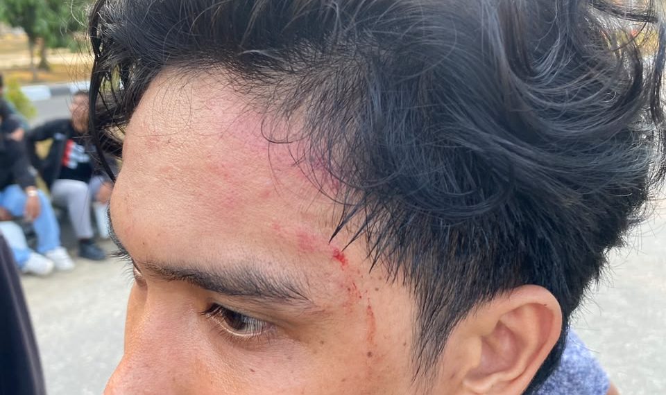 Ketua Umum HMI Komisariat FISIP UHO Cabang Kendari diduga menjadi korban penganiayaan oleh personel Satpol PP saat aksi di Kantor Gubernur Sultra